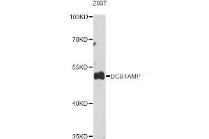Western blot analysis of extracts of various cell lines, using DCSTAMP antibody (ABIN6293906) at 1:1000 dilution. (Transmembrane 7 Superfamily Member 4 (TM7SF4) antibody)