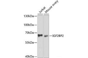 Western blot analysis of extracts of various cell lines using IGF2BP2 Polyclonal Antibody at dilution of 1:1000. (IGF2BP2 antibody)