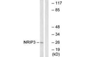 Western blot analysis of extracts from COLO cells, using NRIP3 Antibody.
