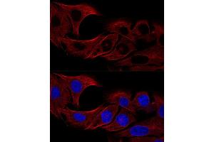 Confocal immunofluorescence analysis of U2OS cells using α-Tubulin antibody (ABIN3020549, ABIN3020550 and ABIN3020551) at dilution of 1:100 (60x lens).