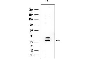 anti-Ras-Like Without CAAX 1 (RIT1) (C-Term) antibody