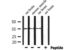 Western blot analysis of extracts from mouse muscle and rat brain and rat heart, using OR52R1 Antibody. (OR52R1 antibody)