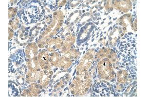 KHK antibody was used for immunohistochemistry at a concentration of 4-8 ug/ml to stain Epithelial cells of renal tubule (arrows) in Human Kidney. (Ketohexokinase antibody)