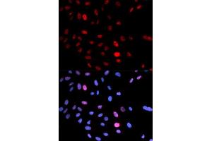 Immunofluorescence (IF) image for anti-Structural Maintenance of Chromosomes 1A (SMC1A) (pSer957) antibody (ABIN3019554) (SMC1A antibody  (pSer957))