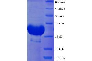 Deiodinase, Iodothyronine, Type III (DIO3) (AA 37-278) protein (His tag) (DIO3 Protein (AA 37-278) (His tag))