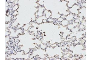 Immunohistochemistry (IHC) image for anti-Eukaryotic Translation Initiation Factor 4A2 (EIF4A2) antibody (ABIN1876482) (EIF4A2 antibody)