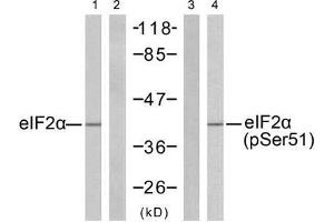 Western blot analysis of extracts from K562 cells untreated or treated with IFN-α (100ng/ml, 20min), using eIF2α (Ab-51) antibody (E021271, Lane 1 and 2) and eIF2α (phospho-Ser51) antibody (E011279, Lane 3 and 4). (EIF2A antibody  (pSer51))