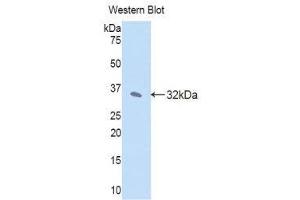 Western Blotting (WB) image for anti-Janus Kinase 2 (JAK2) (AA 120-367) antibody (ABIN3203632) (JAK2 antibody  (AA 120-367))