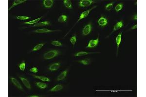 Immunofluorescence of purified MaxPab antibody to RPN2 on HeLa cell. (Ribophorin II antibody  (AA 1-631))