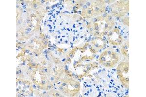 Immunohistochemistry of paraffin-embedded Rat kidney using COTL1 Polyclonal Antibody at dilution of 1:100 (40x lens). (COTL1 antibody)