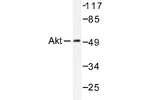 Image no. 1 for anti-V-Akt Murine Thymoma Viral Oncogene Homolog 1 (AKT1) antibody (ABIN265304) (AKT1 antibody)