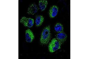 Confocal immunofluorescent analysis of IL13 Antibody (C-term) (ABIN657659 and ABIN2846653) with NCI- cell line followed by Alexa Fluor 488-conjugated goat anti-rabbit lgG (green). (IL-13 antibody  (C-Term))