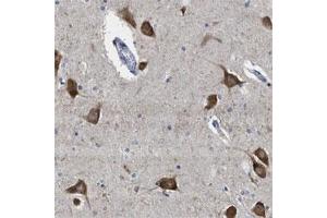 Immunohistochemical staining of human hippocampus shows strong cytoplasmic positivity in neuronal cells.