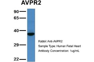 Host: Rabbit  Target Name: AVPR2  Sample Tissue: Human Fetal Heart  Antibody Dilution: 1.