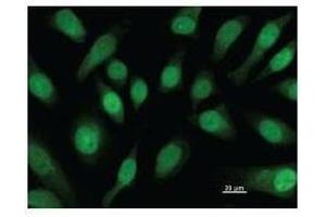 Immunostaining analysis in HeLa cells. (CBFB antibody)