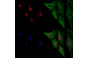 ABIN6266054 and ABIN6276599 staining  cells by IF/ICC. (WT1 antibody  (N-Term))