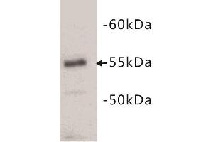 Western Blotting (WB) image for anti-CD4 (CD4) antibody (ABIN1854860) (CD4 antibody)