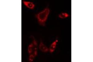 ABIN6275852 staining HuvEc cells by IF/ICC. (PHKG1 antibody  (Internal Region))