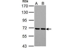 WB Image PCK2 antibody [C1C2], Internal detects PCK2 protein by Western blot analysis. (PEPCK antibody)