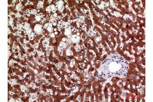 Immunohistochemistry (IHC) analysis of paraffin-embedded Human Liver, antibody was diluted at 1:100. (HSD11B1 antibody  (Internal Region))