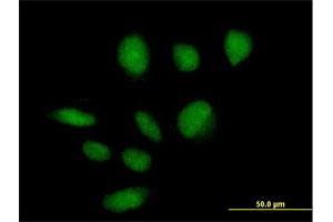 Immunofluorescence of purified MaxPab antibody to ZBTB39 on HeLa cell. (ZBTB39 antibody  (AA 1-712))