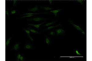 Immunofluorescence of monoclonal antibody to CALCOCO2 on HeLa cell. (CALCOCO2 antibody  (AA 347-446))