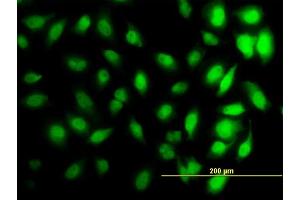 Immunofluorescence of monoclonal antibody to HIST1H3D on HeLa cell.