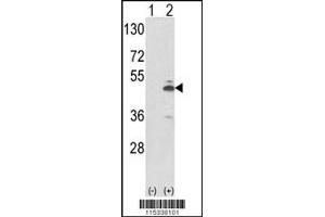 Western blot analysis of PKM2 using rabbit polyclonal using 293 cell lysates (2 ug/lane) either nontransfected (Lane 1) or transiently transfected with the PKM2 gene (Lane 2). (PKM2 antibody  (N-Term))