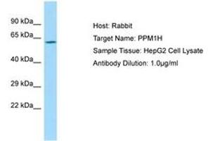 Image no. 1 for anti-Protein Phosphatase 1H (PP2C Domain Containing) (PPM1H) (AA 71-120) antibody (ABIN6750020) (PPM1H antibody  (AA 71-120))