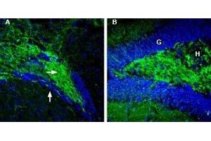Expression of Synapsin-2 in mouse ventral striatum and rat hippocampus - Immunohistochemical staining of perfusion-fixed frozen mouse brain sections with Anti-Synapsin II (SYN2) Antibody (ABIN7043787, ABIN7044660 and ABIN7044661), (1:200), followed by goat-anti-rabbit-AlexaFluor-488 (green staining). (SYN2 antibody  (Domain G, Intracellular))