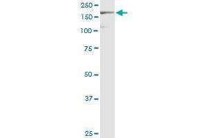 EIF3A monoclonal antibody (M02), clone 2G4. (EIF3A antibody  (AA 1-75))