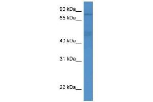 ADD3 antibody used at 0. (ADD3 antibody  (Middle Region))