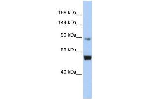 MCM10 antibody used at 1 ug/ml to detect target protein. (MCM10 antibody  (Middle Region))