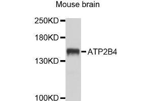 Western blot analysis of extracts of mouse brain cells, using ATP2B4 antibody.
