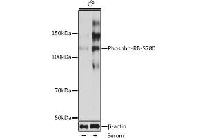 Western blot analysis of extracts of C6 cells, using Phospho-RB-S780 Rabbit mAb (ABIN7269936) at 1:1000 dilution. (Retinoblastoma 1 antibody  (pSer780))