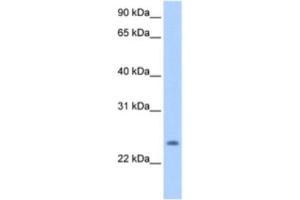 Western Blotting (WB) image for anti-PQ Loop Repeat Containing 1 (PQLC1) antibody (ABIN2463302)