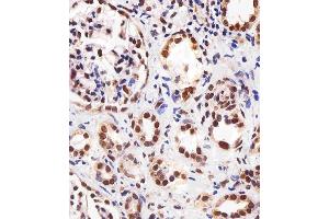 Immunohistochemical analysis of paraffin-embedded H. (PPARA antibody  (AA 1-468))