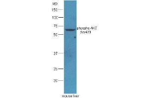Mouse liver lysates probed with Rabbit Anti-AKT(Ser473) Polyclonal Antibody, Unconjugated  at 1: 5000 for 90min at 37˚C. (AKT 1/2/3 antibody  (pSer473))