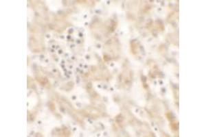 Immunohistochemical analysis of NKX2-8 in human liver tissue with NKX2-8 polyclonal antibody  at 2. (NKX2-8 antibody  (Internal Region))