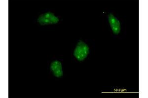 Immunofluorescence of purified MaxPab antibody to DLX1 on HeLa cell. (DLX1 antibody  (AA 1-255))
