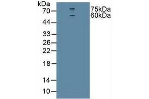 Detection of CHRNa4 in Human U-87MG Cells using Polyclonal Antibody to Cholinergic Receptor, Nicotinic, Alpha 4 (CHRNa4) (CHRNA4 antibody  (AA 49-242))