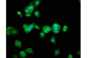 Immunofluorescence staining of HepG2 cells with ABIN7172879 at 1:266, counter-stained with DAPI. (TRPV2 antibody  (AA 1-117))