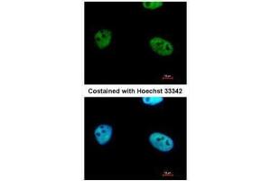 ICC/IF Image Immunofluorescence analysis of paraformaldehyde-fixed HeLa, using WTAP, antibody at 1:500 dilution. (WTAP antibody  (Center))