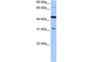Western Blotting (WB) image for anti-Tetra-Peptide Repeat Homeobox-Like (TPRXL) antibody (ABIN2463460) (TPRXL antibody)