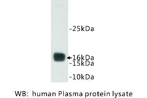 Image no. 1 for anti-Transthyretin (TTR) antibody (ABIN1112826)