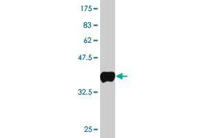 SMARCA5 antibody  (AA 59-147)