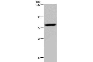 Western Blot analysis of PC3 cell using NR4A1 Polyclonal Antibody at dilution of 1:200 (NR4A1 antibody)