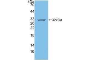 Detection of Recombinant BFP, Rat using Polyclonal Antibody to Brain Finger Protein (BFP) (RNF112 antibody  (AA 256-504))