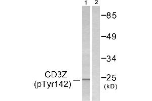 Western blot analysis of extracts from Jurkat cells, treated with UV (15mins), using CD3 ζ (Phospho-Tyr142) antibody. (CD247 antibody  (pTyr142))