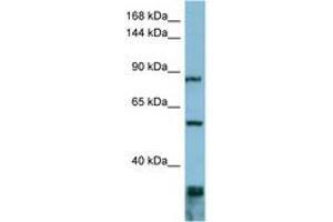 Image no. 1 for anti-Epidermal Growth Factor Receptor Pathway Substrate 8 (EPS8) (AA 647-696) antibody (ABIN6741834) (EPS8 antibody  (AA 647-696))